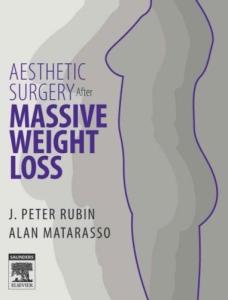 Aesthetic Surgery After Massive Weight Loss