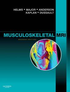 Musculoskeletal MRI, 2nd Edition
