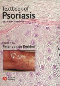 Textbook of Psoriasis, 2nd Edition